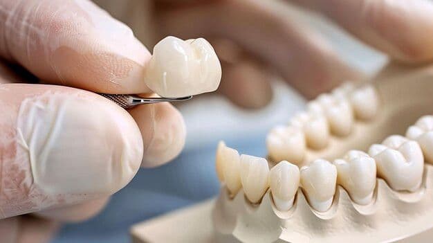 Crown and bridge dental restoration