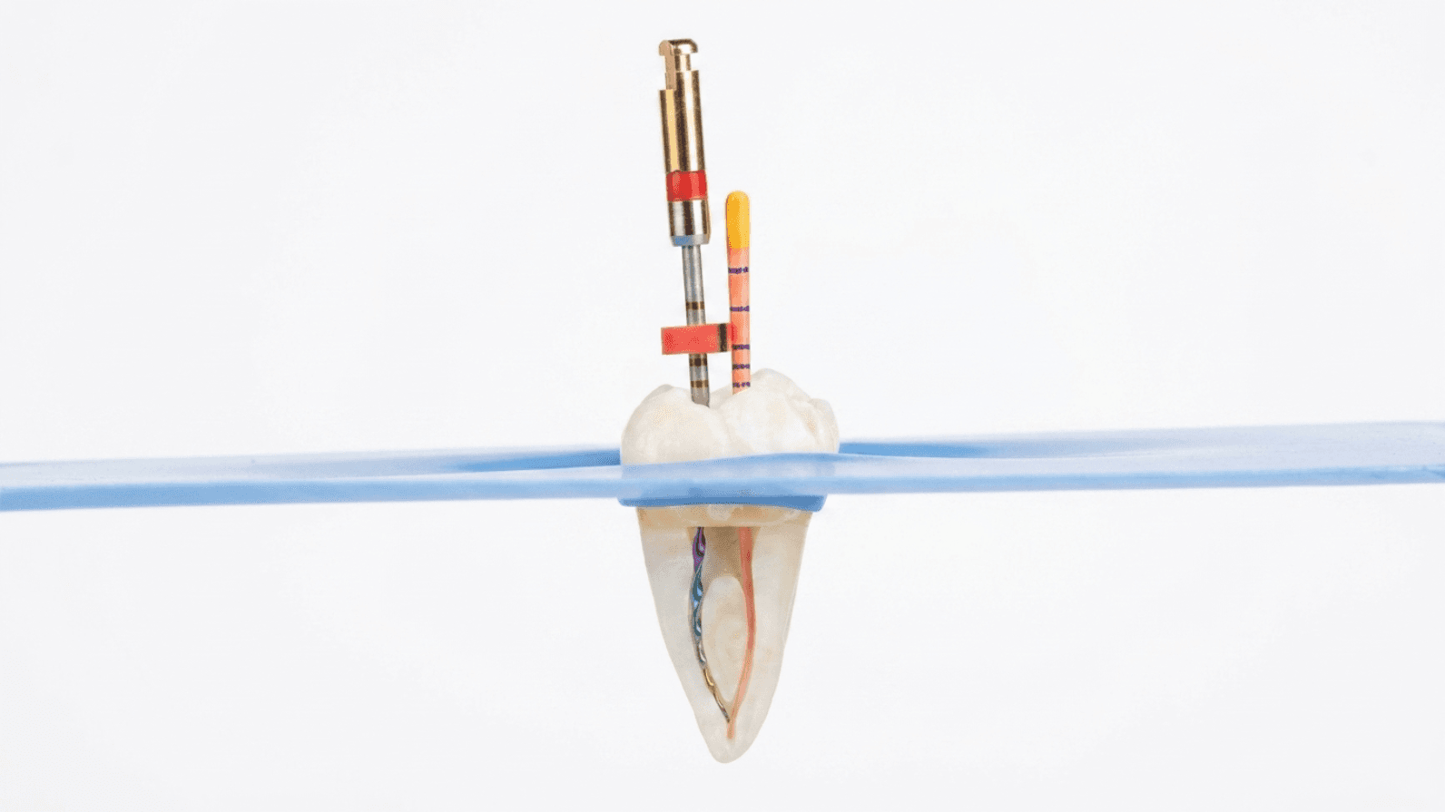 Why You Shouldn't Delay a Root Canal Treatment: Pain Relief, Procedure, and Tooth Preservation
